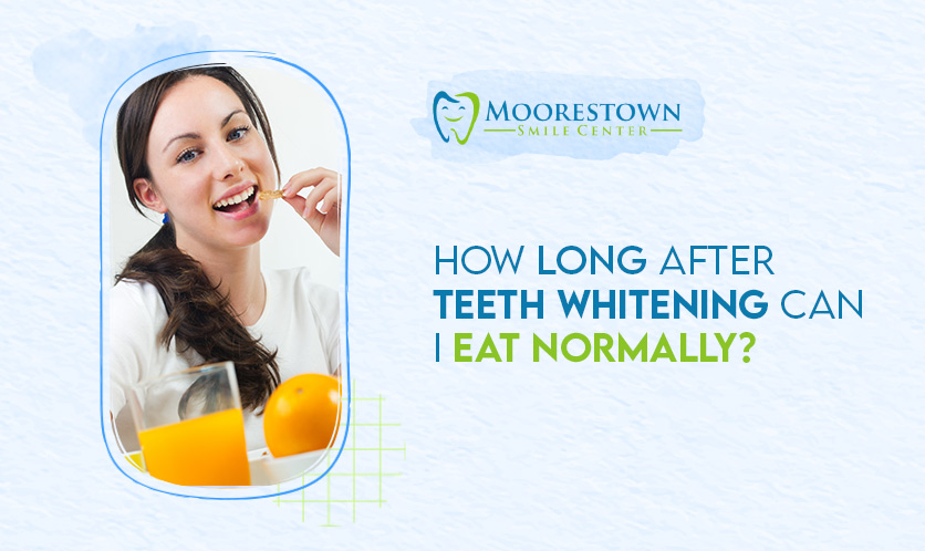 How Long After Teeth Whitening Can I Eat Normally?